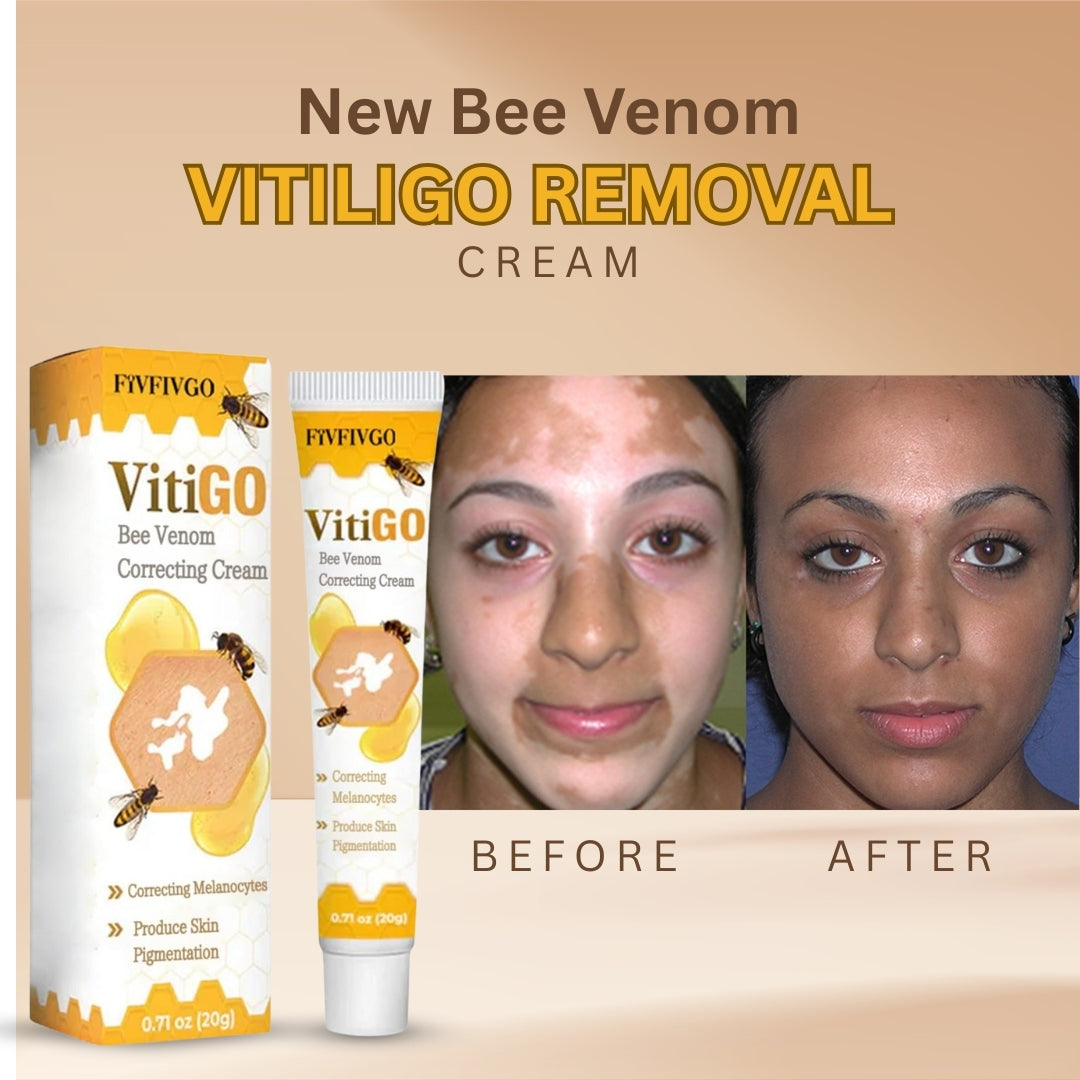 VitLego Removal Cream