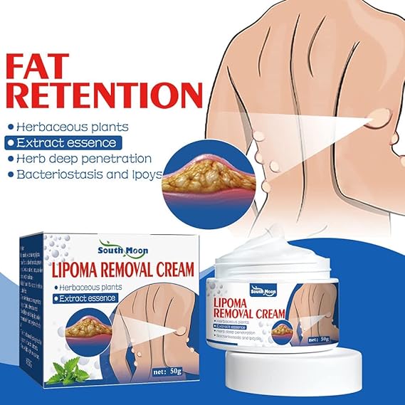 South Moon Lipoma Removal Cream || BUY ONE GET ONE FREE
