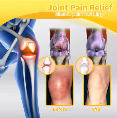 OSTEOARTHRITIS ARTHRITIS CREAM - NEW GENERATION JOINT PAIN TREATMENT GEL